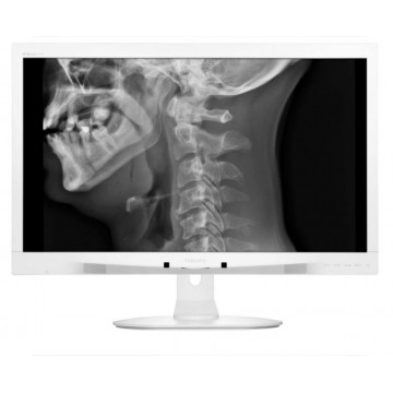 Philips Brilliance Moniteur LCD avec D-image clinique C271P4